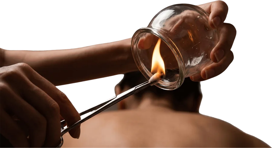 A practitioner holding a glass cup while a flame heats the air inside it